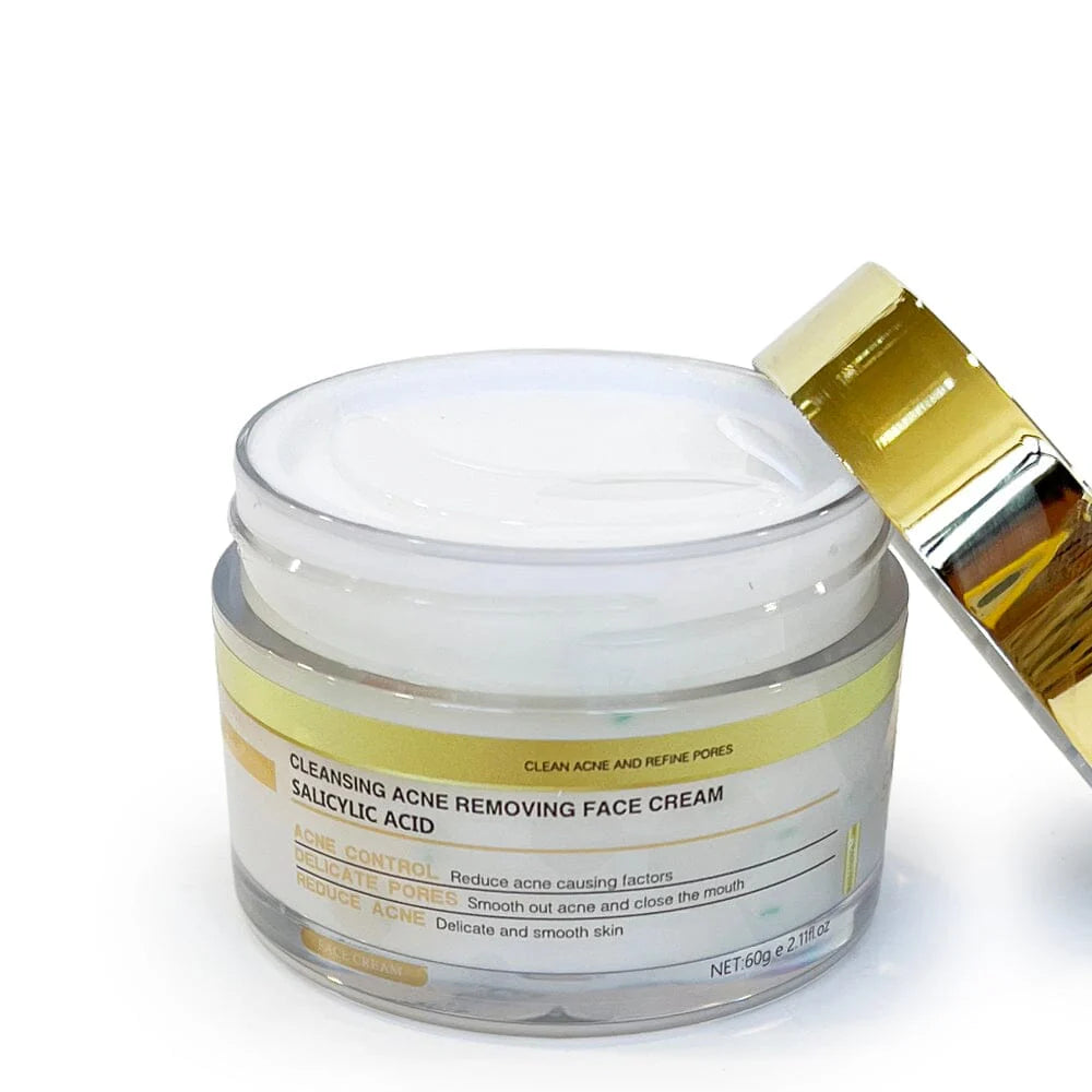 Simply Bella - Acne Removing Face Cream - Salicylic Acid