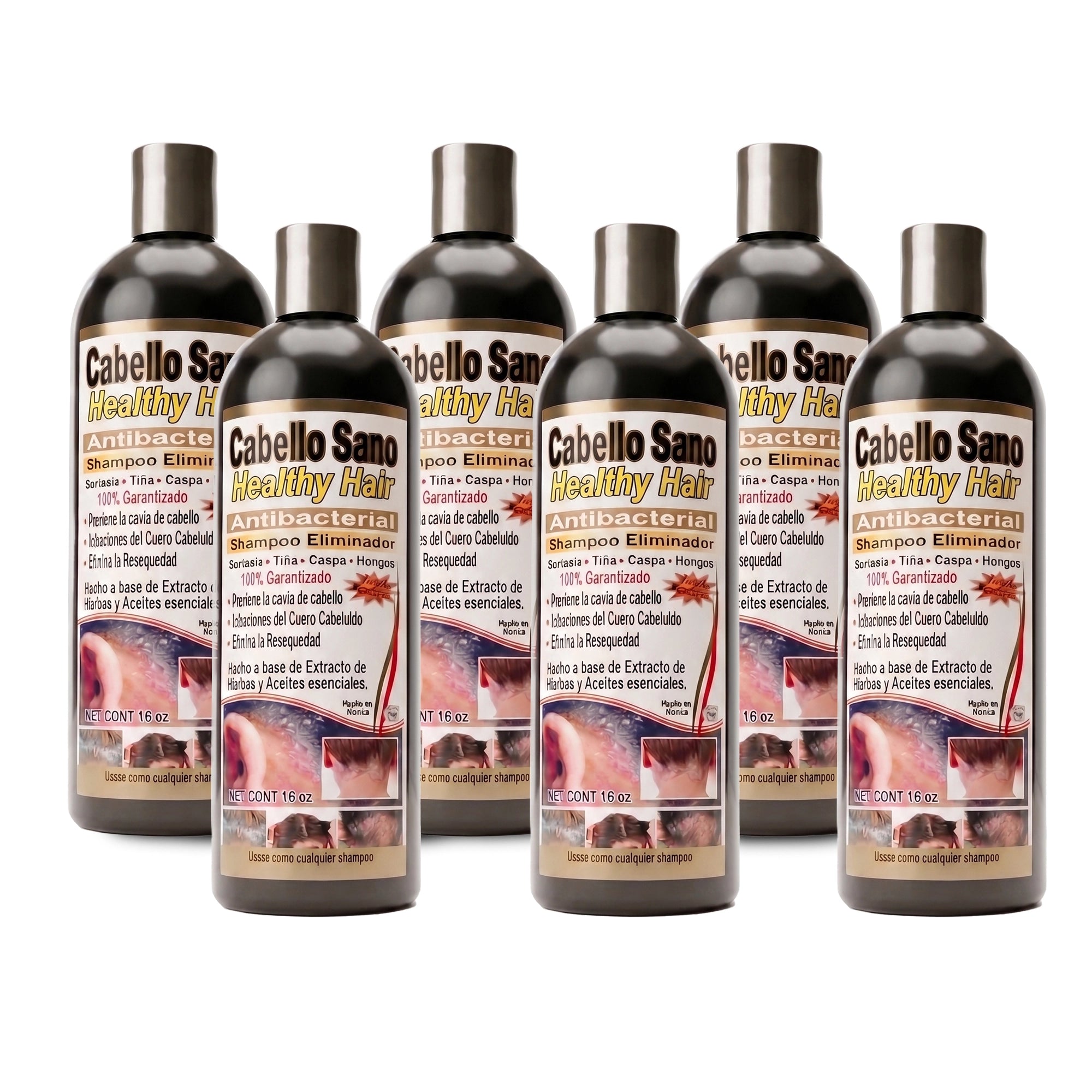 Cabello Sano Antibacterial Shampoo (6-Pack, 16 oz Each) – Scalp Treatment for Dandruff, Ringworm, Dryness & Irritation | Natural Herbal Formula