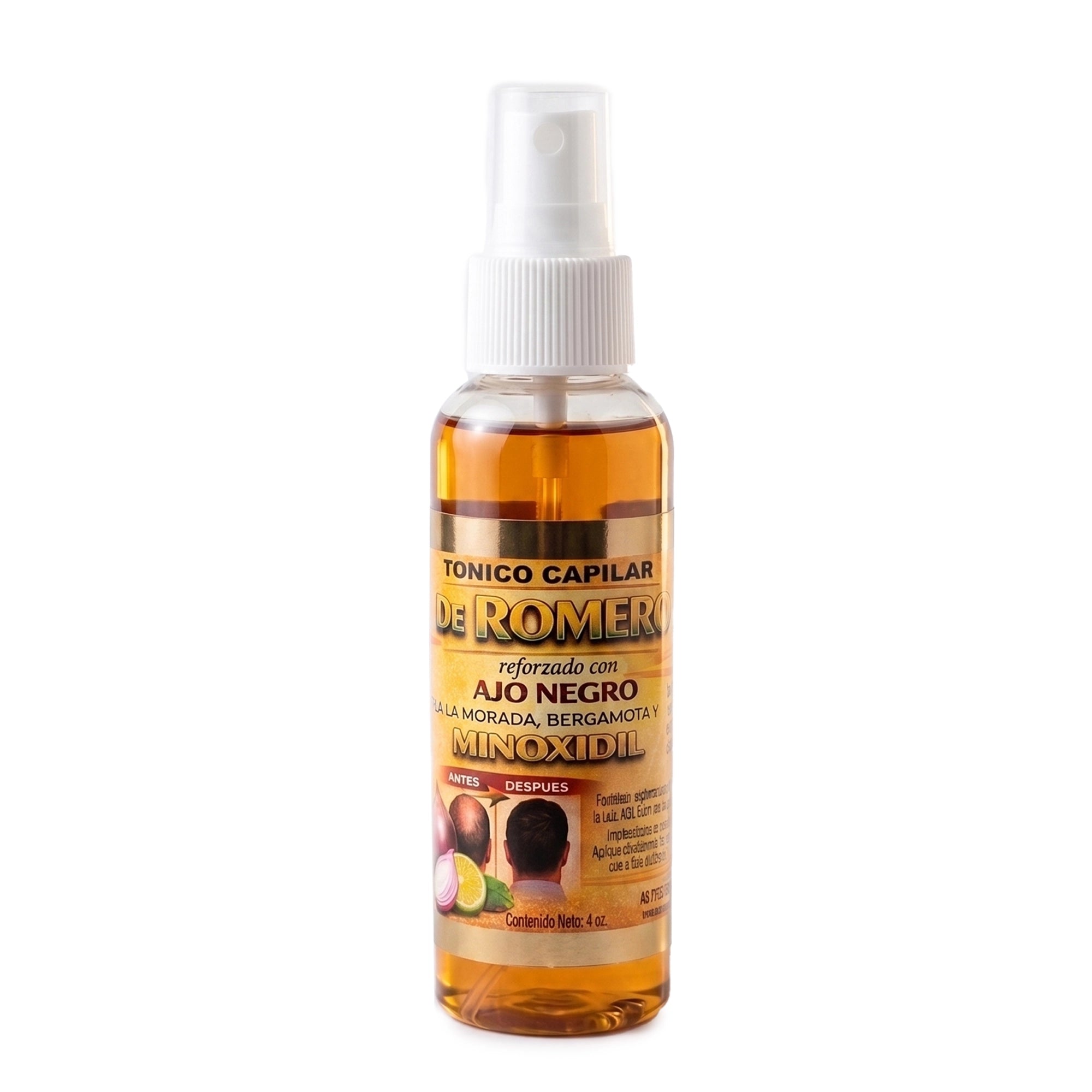 6-Pack Rosemary Hair Tonic Spray with Minoxidil, Black Garlic & Bergamot (4 oz) – Hair Growth & Thinning Treatment for Men & Women