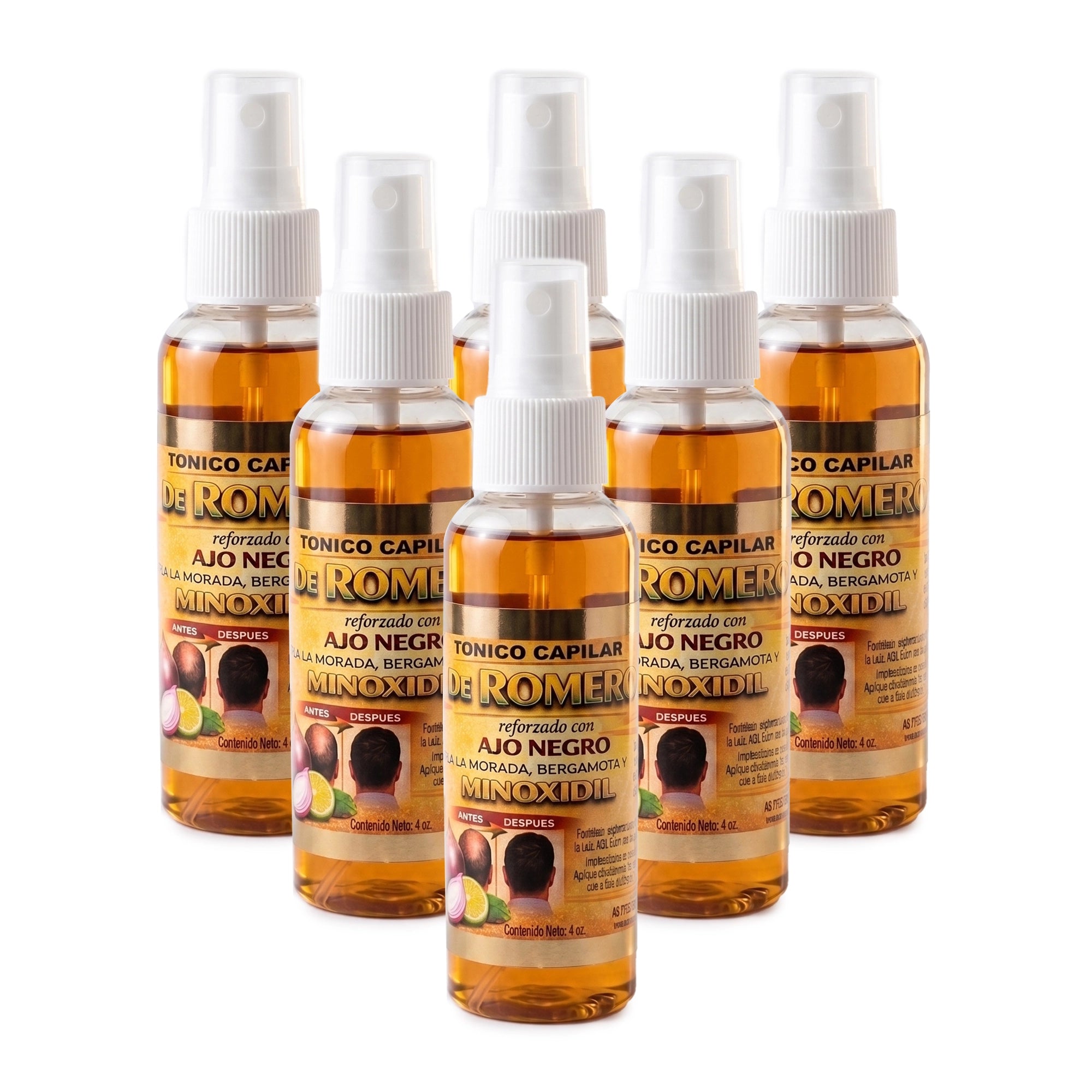 6-Pack Rosemary Hair Tonic Spray with Minoxidil, Black Garlic & Bergamot (4 oz) – Hair Growth & Thinning Treatment for Men & Women