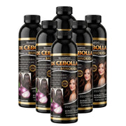 Onion Shampoo Reinforced with Minoxidil (6 Pack) – Premium Hair Growth & Anti-Hair Loss Formula